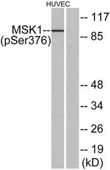 MSK1 (phospho Ser376) rabbit p