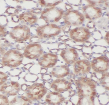 TIMP2 Antibody抗体，orb631910，bio