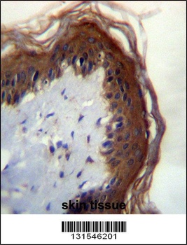 LIPM Antibody抗体，orb1269540，bio