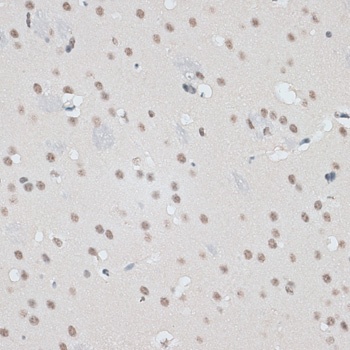 RBM17 Antibody抗体，orb1257908，bi