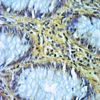 ALDH1B1 Antibody抗体，orb213549，b