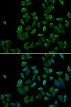 PEX5 Antibody抗体，orb1257330，bio