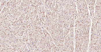 ATP1B1 Recombinant Rabbit Mono