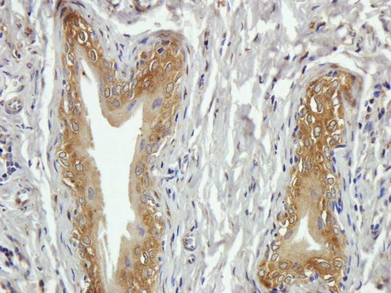 CD20 antibody抗体，orb10307，biorb