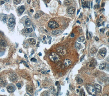 TNS4 Antibody抗体,orb632037,bior