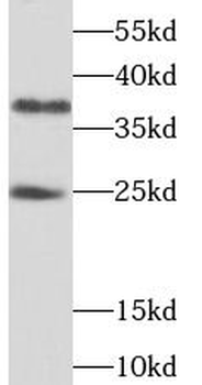 THAP1 Antibody抗体，orb631866，bio