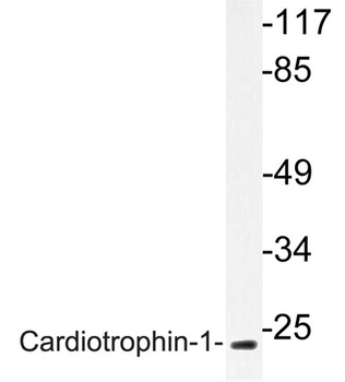 Cardiotrophin-1 rabbit pAb抗体，o
