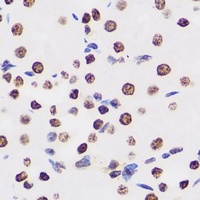 BAF155 Antibody抗体，orb340999，bi