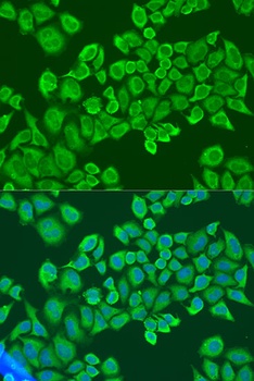 IGF2BP2 Antibody抗体,orb1258064,