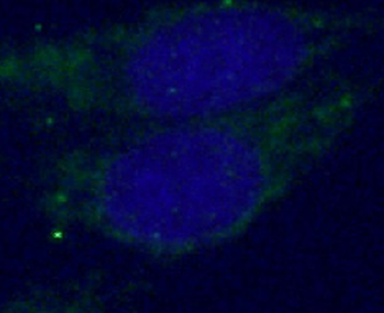 SYT1 Antibody抗体，orb631672，bior