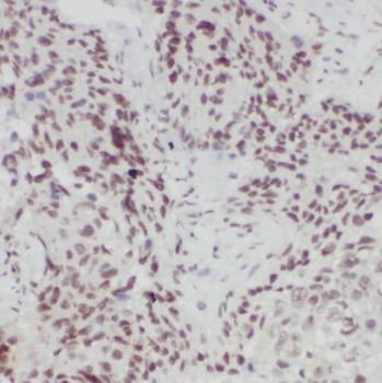 TLE3 Antibody抗体，orb631923，bior