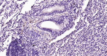 Tau-4 Mouse Monoclonal Antibod