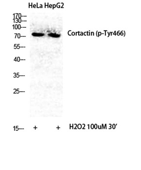 Cortactin (phospho Tyr466) rab