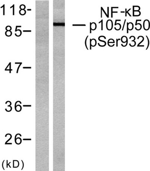 NFκB-p105 (phospho Ser932) rab