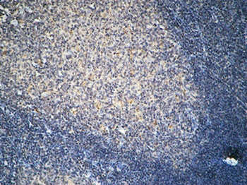 FSHR rabbit pAb抗体，orb765253，bi