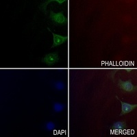 MYO7A Antibody抗体，orb215496，bio