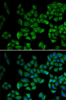 PRDX5 Antibody抗体，orb1257089，bi