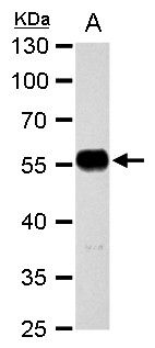 alpha Tubulin 1A antibody抗体，or