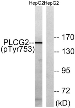 PLC γ2 (phospho Tyr753) rabbit