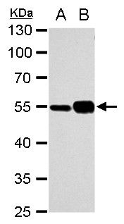 alpha Tubulin 1A antibody抗体，or