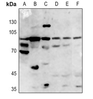 ACSL4 Antibody抗体，orb412494，bio