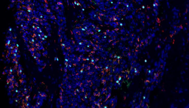 诺奖解码免疫 “刹车”：Absin mIHC服务赋能Treg细胞研究新突破