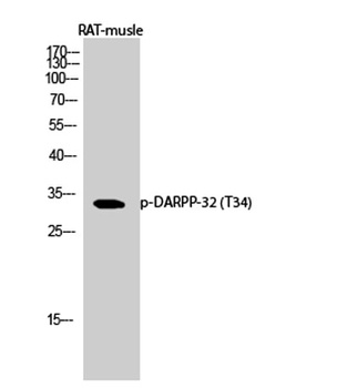 DARPP-32 (phospho Thr34) rabbi