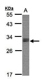 NSMCE1 antibody [N1C3]抗体，orb55