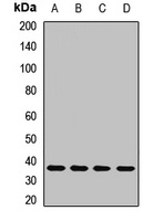 Thymidylate Synthase Antibody抗