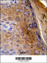 KRT10 Antibody抗体,orb1263710,bi