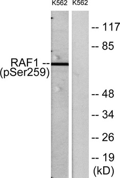 Raf-1 (phospho Ser259) rabbit 