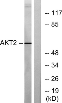 Akt2 rabbit pAb抗体，orb764511，bi