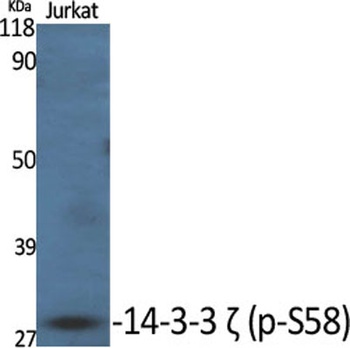 14-3-3 ζ (phospho Ser58) rabbi