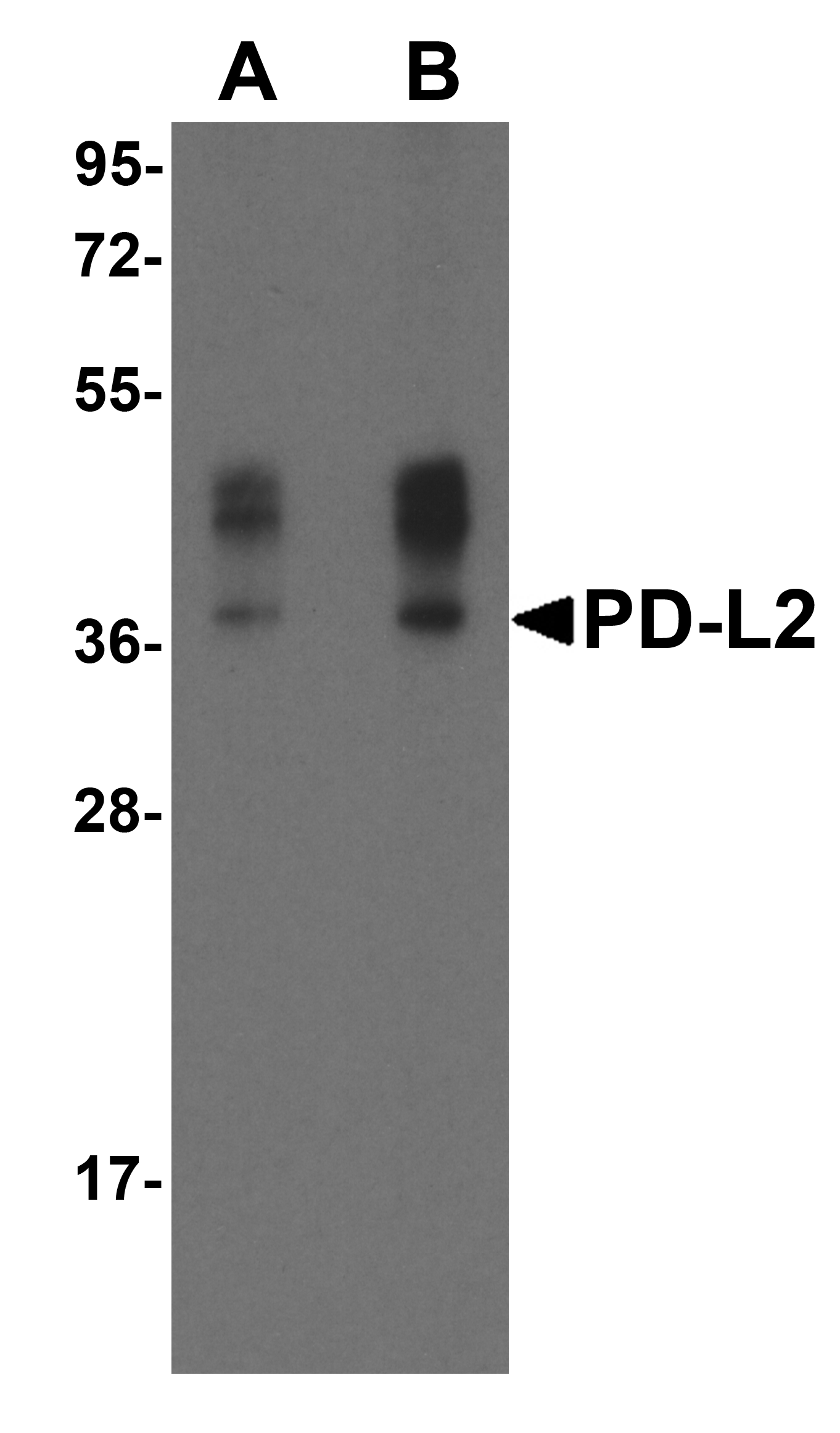 PDL2 Antibody [4E10]抗体，orb1239853，biorbyt价格_品牌:biorbyt-丁香通