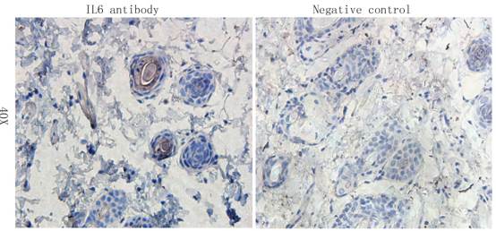 IL6 antibody抗体，orb6210，biorbyt