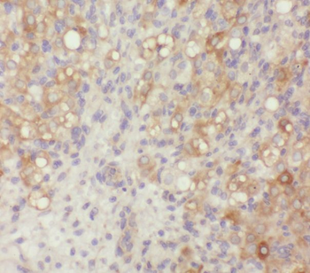 ZER1 Antibody抗体,orb632713,bior