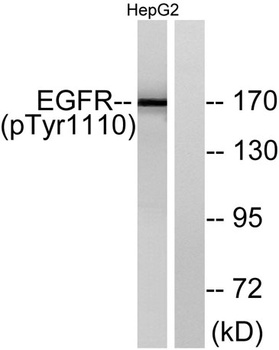 EGFR (phospho Tyr1110) rabbit 