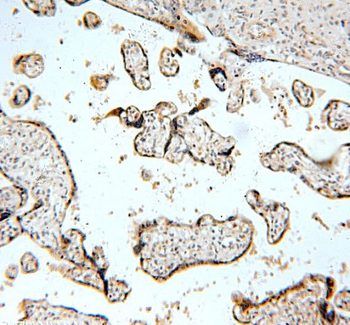 TNFAIP1 Antibody抗体,orb632006,b