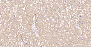 Tau-4 Mouse Monoclonal Antibod