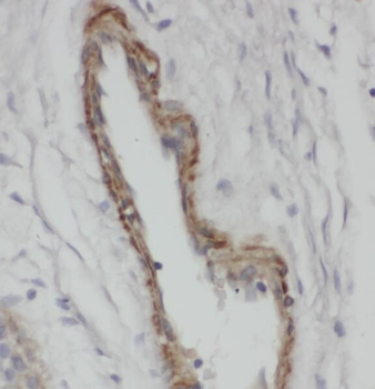 SNX1 Antibody抗体，orb631382，bior