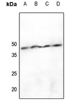 hnRNP D0 (Phospho-S83) Antibod