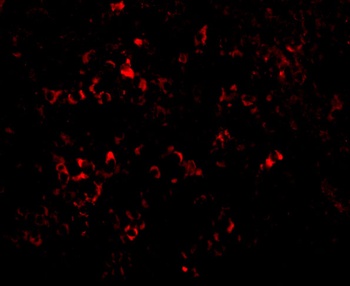 PAK2 Antibody抗体，orb1239715，bio