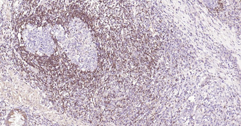 Bcl-2 Recombinant Rabbit Monoc