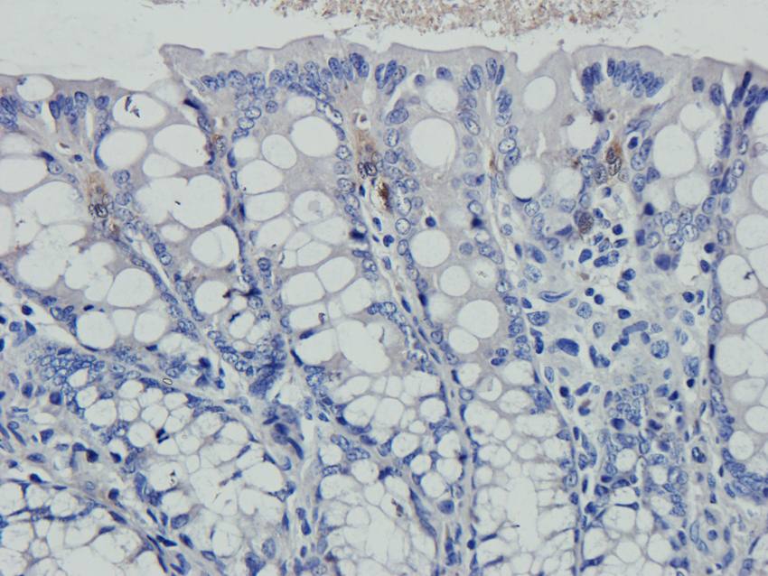 ABCG2 antibody抗体,orb155559,bio