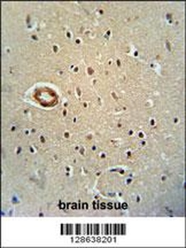 CWC22 Antibody抗体，orb1270587，bi