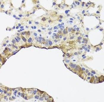 TOMM34 Antibody抗体,orb632048,bi