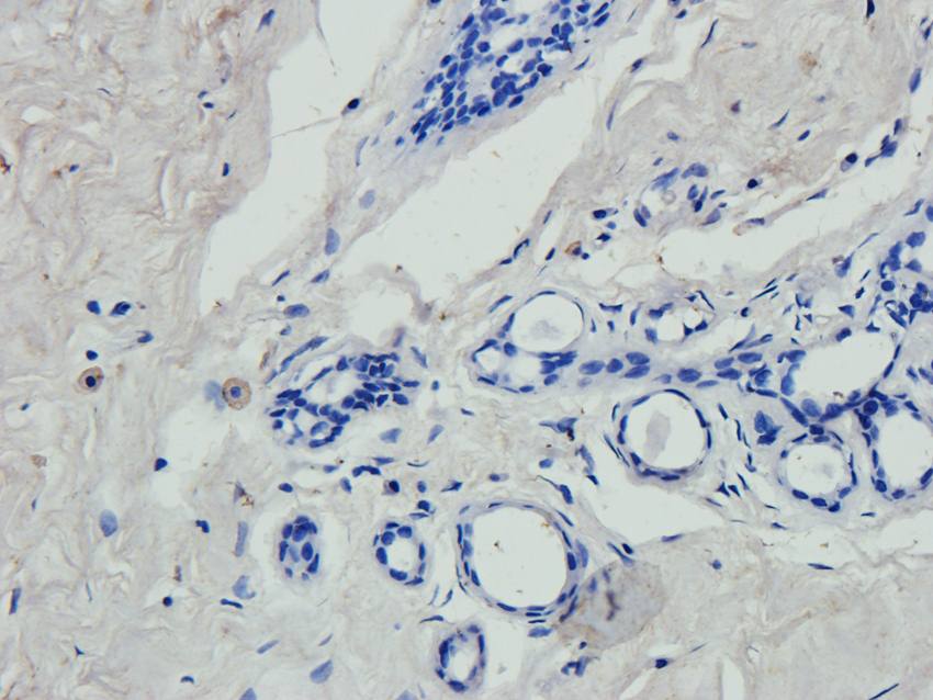 ABCG2 antibody抗体,orb155559,bio