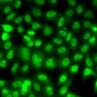 TBL1XR1 Antibody抗体,orb668359,b