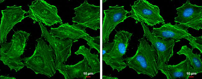 beta Actin antibody抗体，orb55590