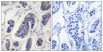 DZIP3 rabbit pAb抗体，orb770958，b